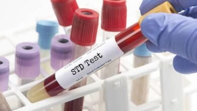 STD Test