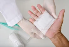 The Importance of Proper Wound Care Dressings in Preventing Infections